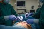 Maynard Operation Sequence Technique : principes et niveaux